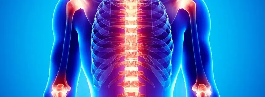 carnivore diet inflammation