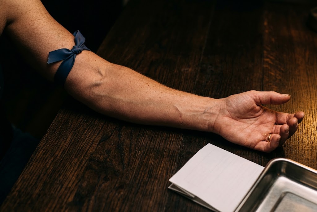 A woman's forearm resting on a dark table with a tourniquet above the elbow, ready for a blood draw
